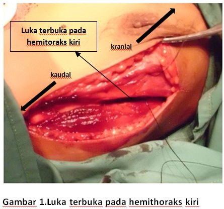 TORAKOTOMI ADALAH EPUB TORAKOTOMI ADALAH EPUB